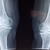 Why Are My Joints Painful?